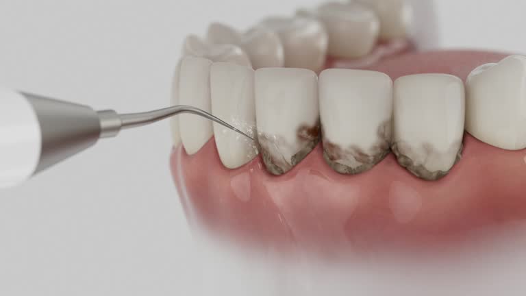 Reliable Wisdom Tooth Removal contractor in Dickson County County, TN by Dentist Open Now